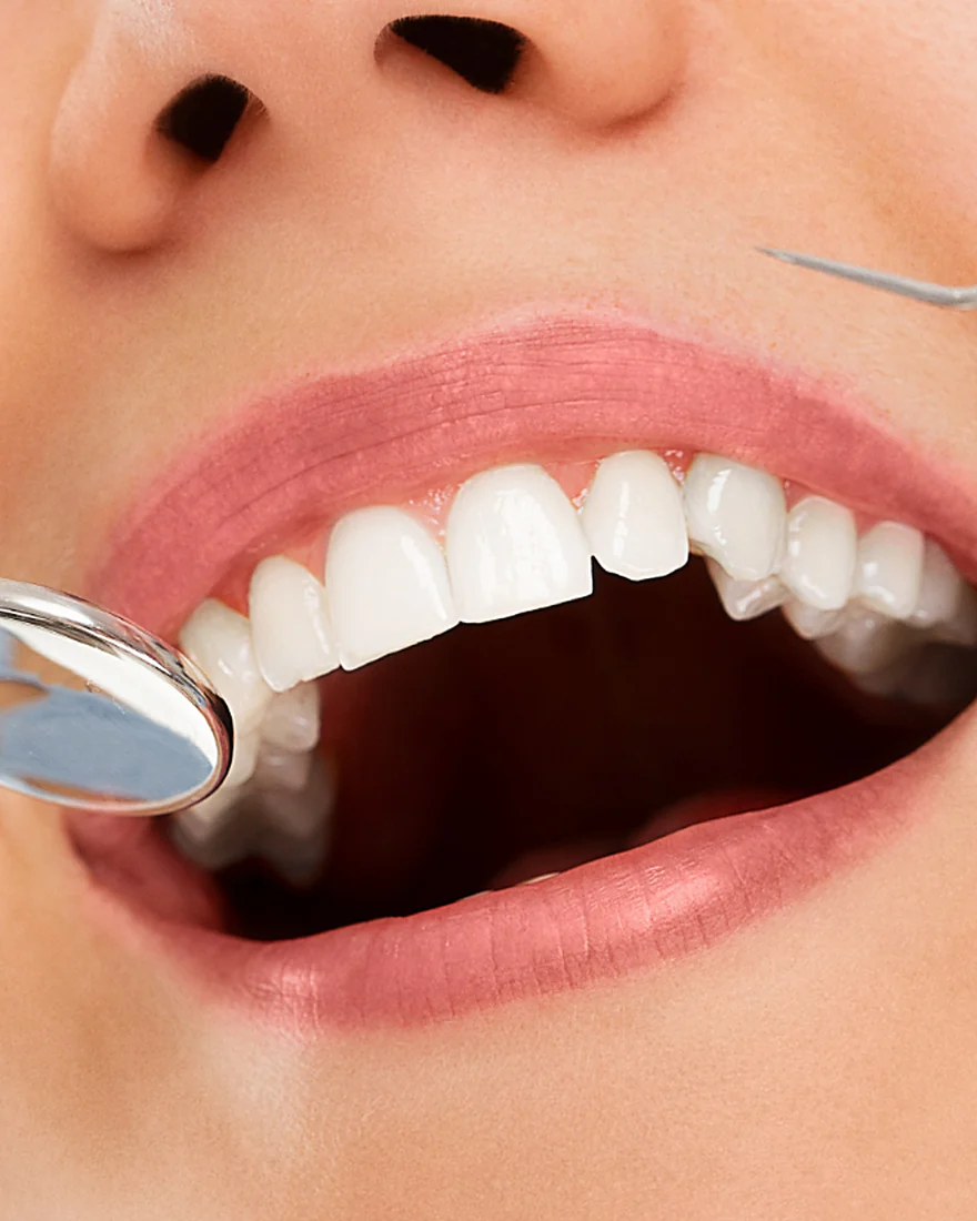 Limpieza dental profesional con espejo y ultrasonido