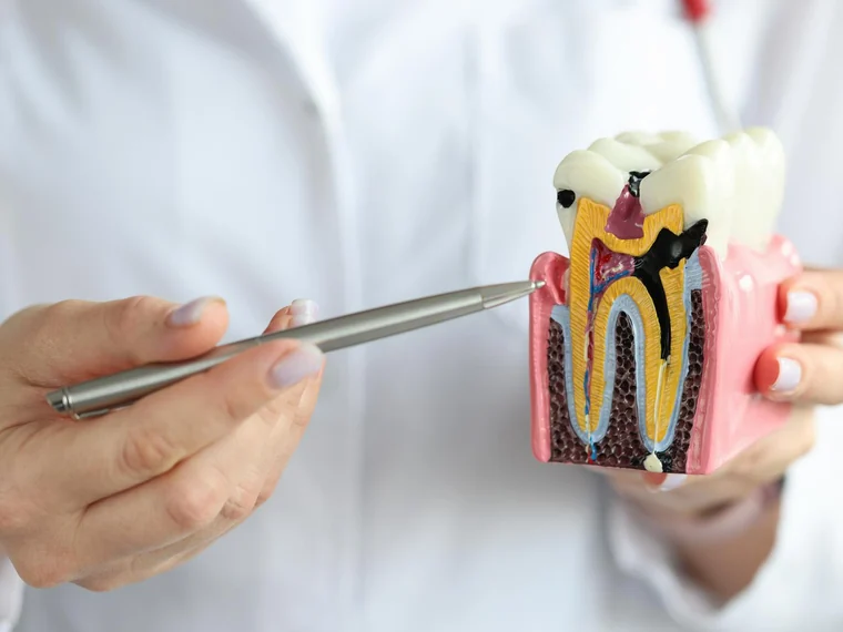 Periodoncia